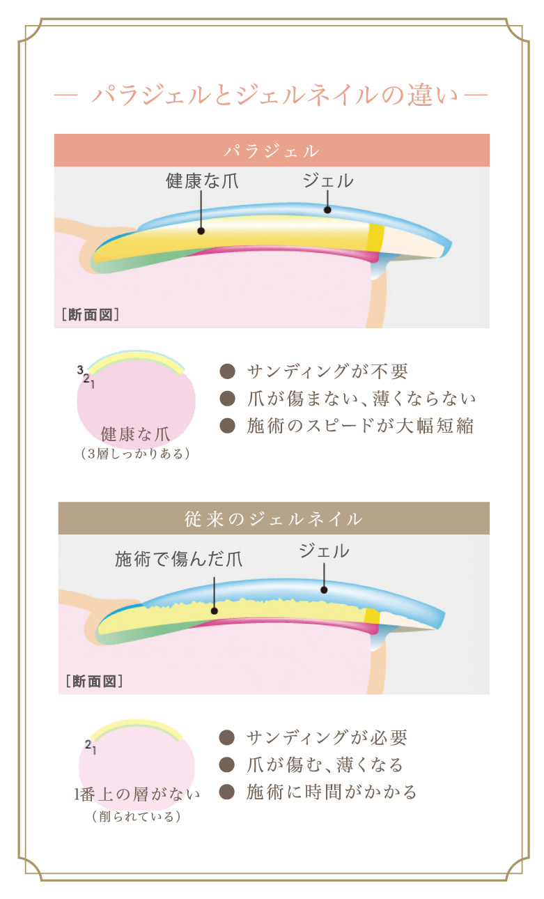 パラジェルとジェルネイルの違い